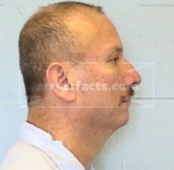 Michael R. Sallee
