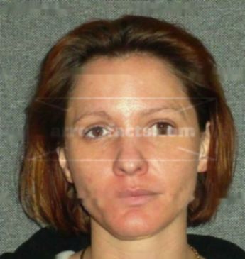 Natalie A Winiarczyk