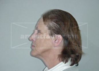 Rhonda M Peterson