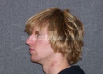 Patrick J Lemmon