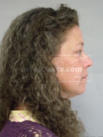 Mary A Greening