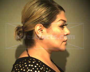 Norma Vega Sanchez
