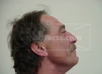 Todd E La Canne