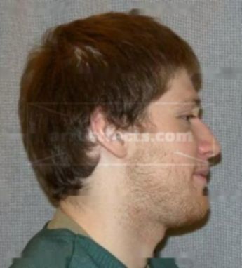 Matthew J Minnick