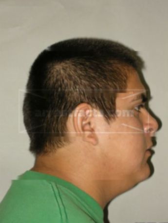 Francis Torres