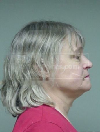 Bonnie A Dejewski