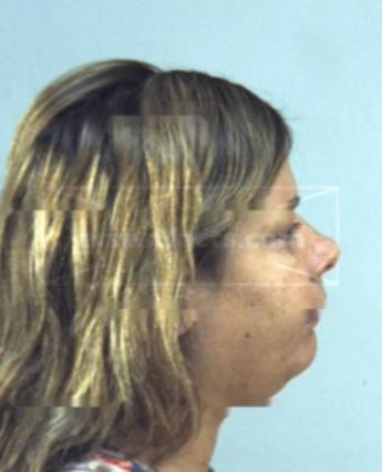 Alicia Ross
