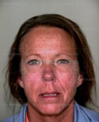 Beverly S Krohn