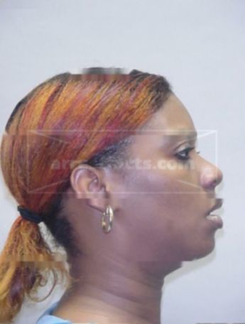 Sharon E Johnson