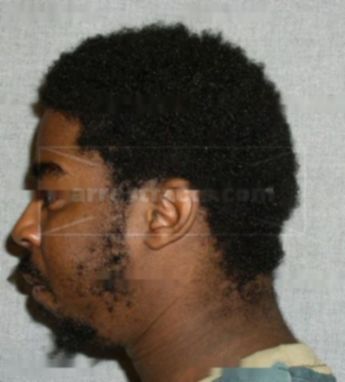 Quentin F Robinson