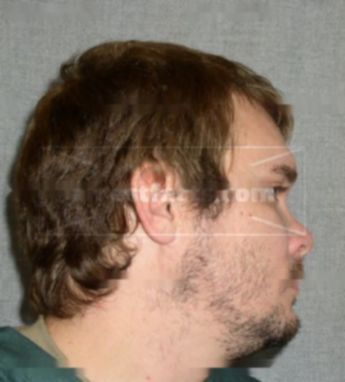 Jeremy J Strenke