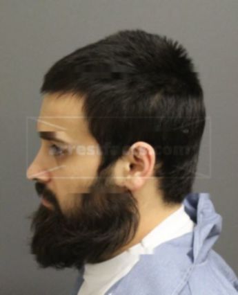 Ryan Burgess Deoraj