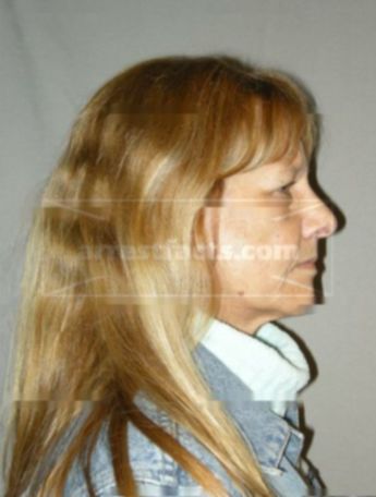 Heidi L Carlson