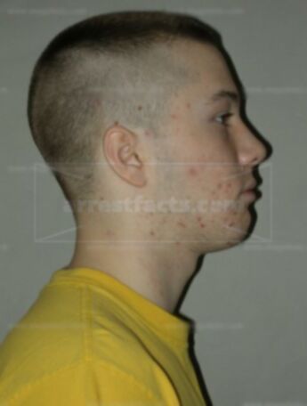 Bradley Joseph Watermolen