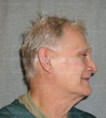 Peter Reifkohl