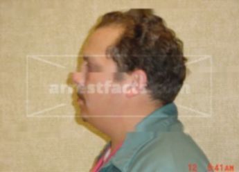 Todd D Cassiani