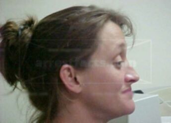 Teresa Lightfoot