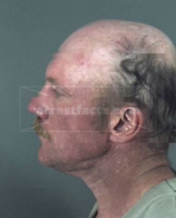 Anthony Charles Seeley
