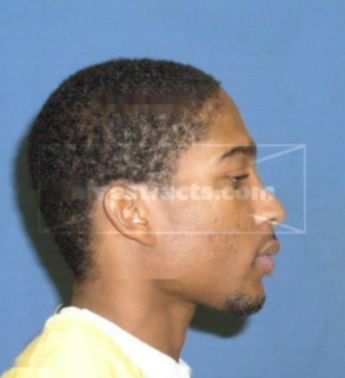 Emmanuel R Hamilton