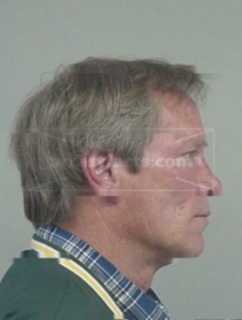 Richard N Kane