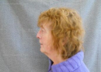 Lois E Minnich