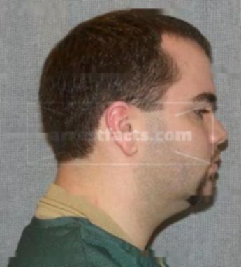 Kory R Garczynski