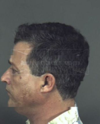 Mark Richard Stapleton