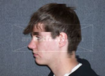 Jonathan J Flesch