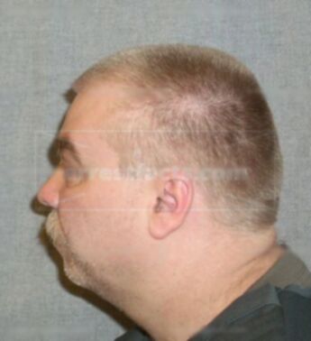 Steven Avery