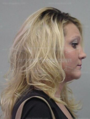 Allyson L Finch