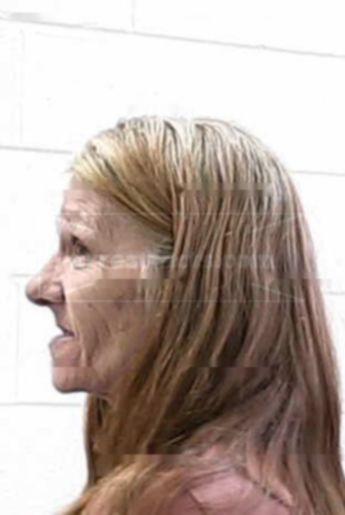 Carolyn Starr Hurt