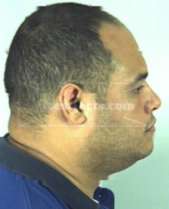 Miguel Angel Ortiz