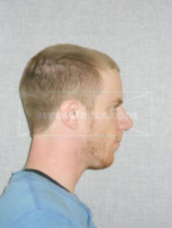 Andrew W Krombholz