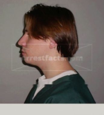 Nicholas A Hillmer
