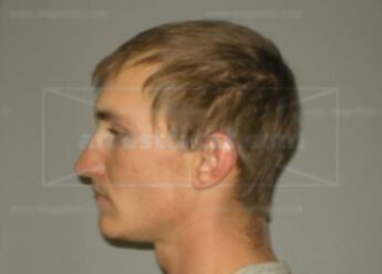 Bradley M Neumann