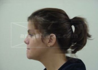Sara A Berg