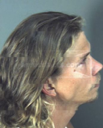 Lonnie Joseph Blake