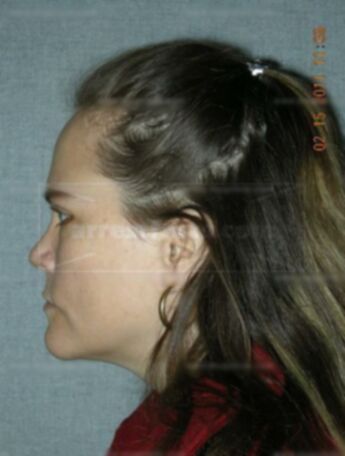 Tamra L Schott