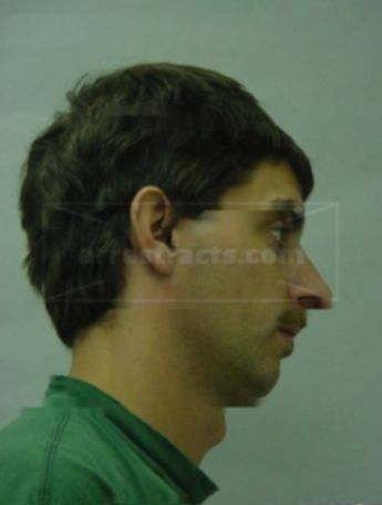 Christopher J Benzow