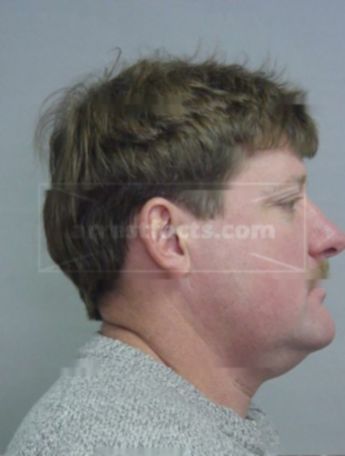 Todd J Knickelbine