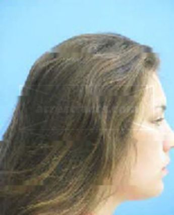 Alexis Renee Lovett