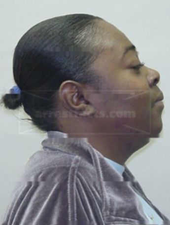 Keishe L Easton