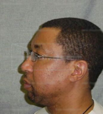 Otis B Bledsoe