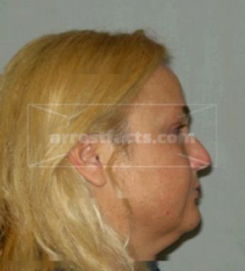 Debra L Stark