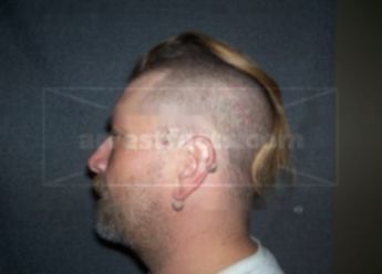 Jay A Lundgren