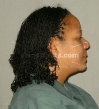 Anitra Dowell