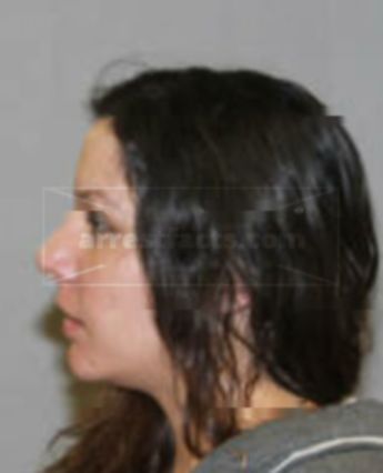 Melanie Renee Brinkerhoff