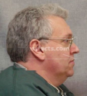 Peter J Hoyt