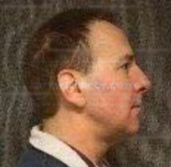 Frank J Horzen