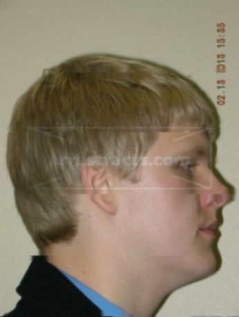 Jacob L Johnson